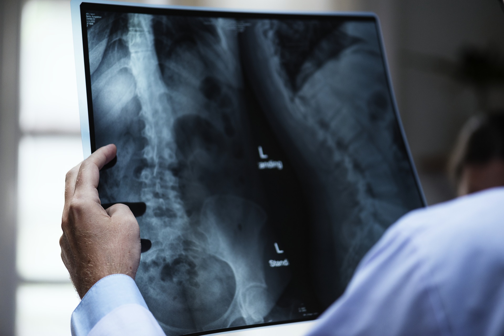Healthcare Content Marketing - bone xray